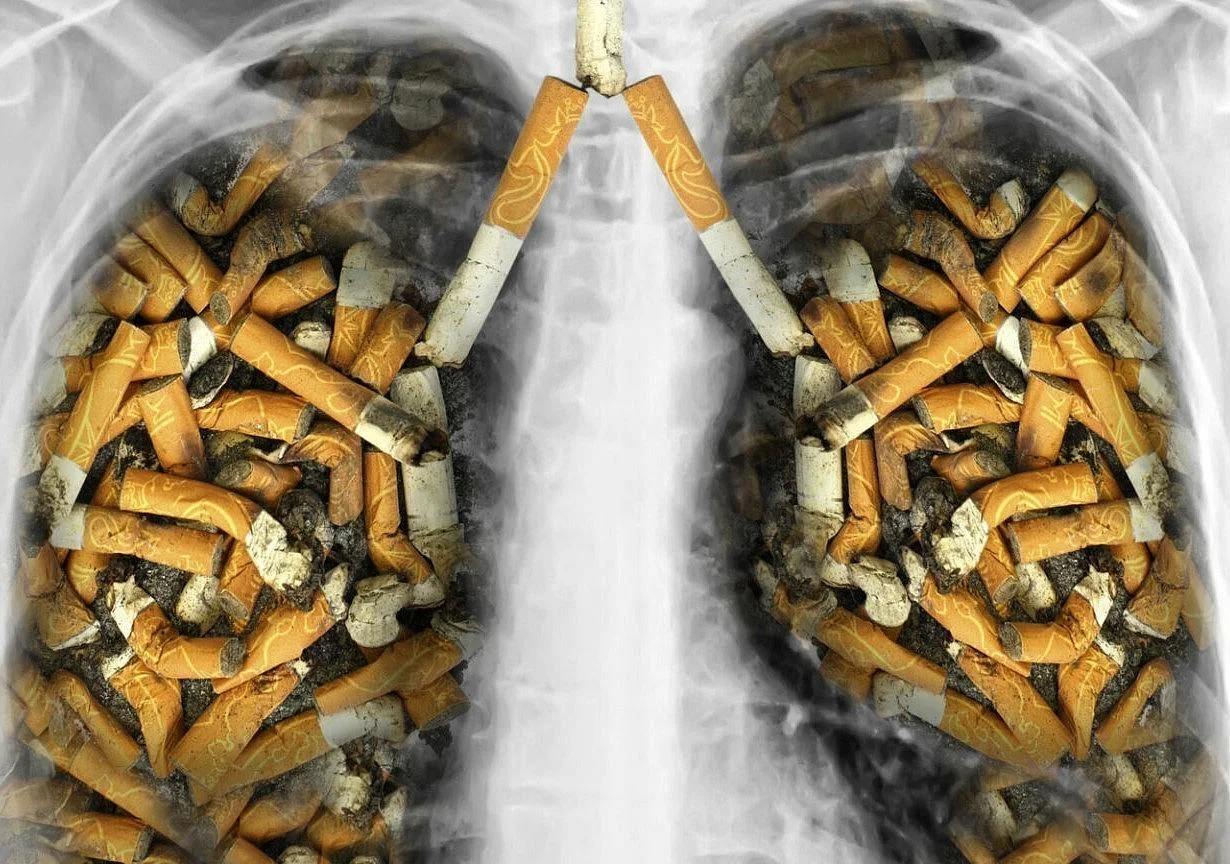 К раку легких приводят курение и загрязнение воздуха К раку легких приводят курение и загрязнение воздуха