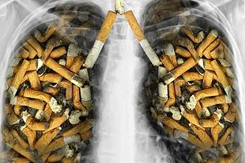 К раку легких приводят курение и загрязнение воздуха