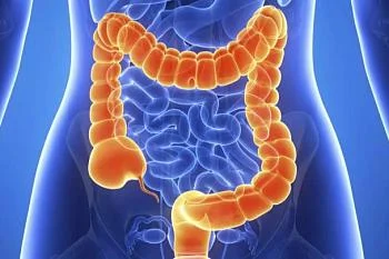 Колоректальный рак: распространен и опасен!