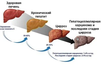 С 28 июля по 3 августа проводится неделя профилактики заболеваний печени